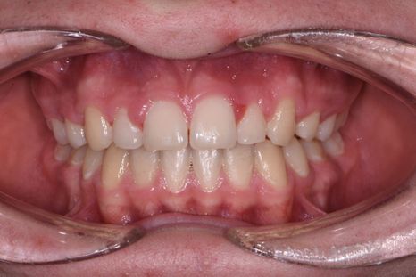 orthodontie - 12