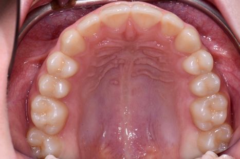 orthodontie - 43