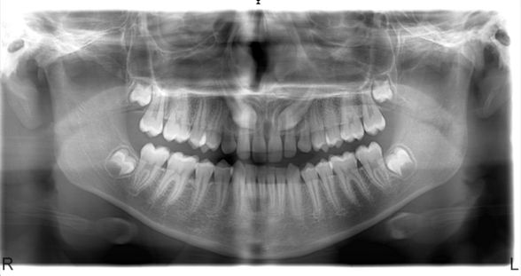 orthodontie - 67